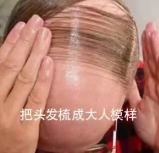秃头少女有救了！想要发量暴增先搞清楚这10个问题